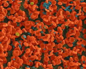 浙江大学发现铁调蛋白抵御细菌感染新机制 浙江大学发现铁调蛋白抵御细菌感染新机制